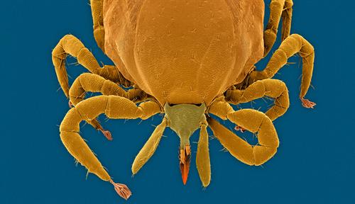 Scanning electron microscope image of a tick, colored tan with a blue background.