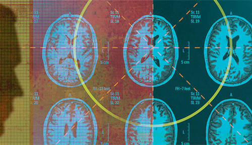 Illustration shows a physician analyzing MRI brain scans.