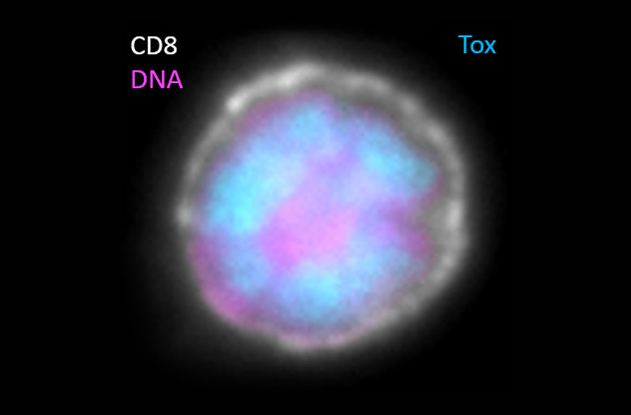 Exhausted immune cell micrograph showing high levels of the protein Tox in the nucleus.