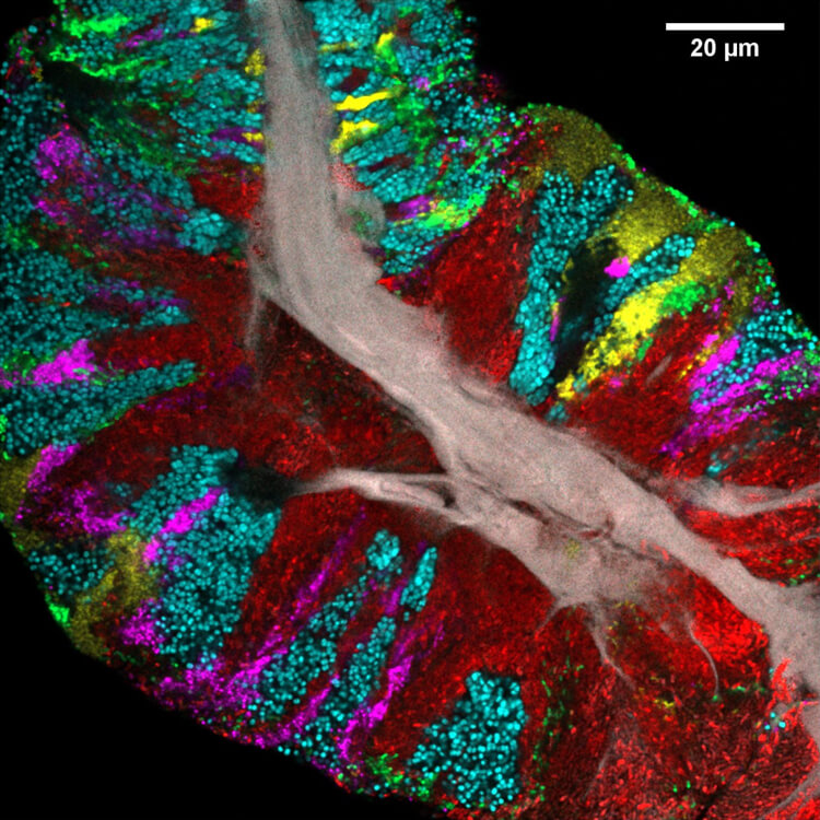 Fluorescent microscopic image shows the organization of bacteria living on the tongue.