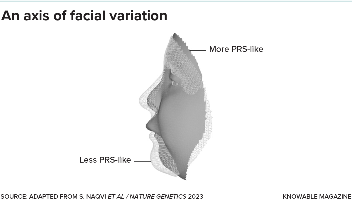 Profile view superimposes two faces, one with longer nose and more pronounced chin, the other with flat face, elongated upper lip and receding chin