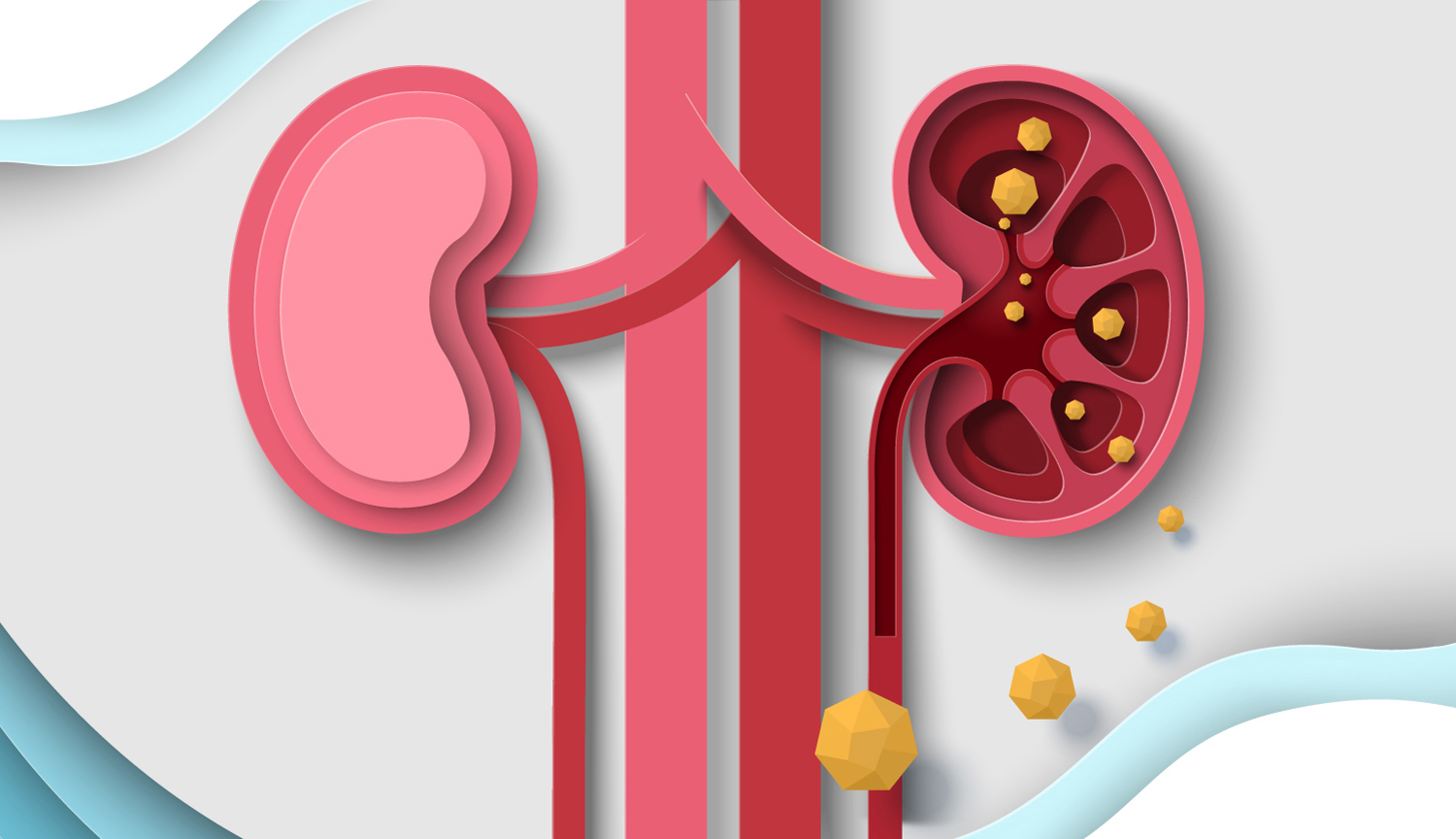 Illustration of two kidneys, ureters and some major blood vessels, with some yellow blobs depicting a drug.