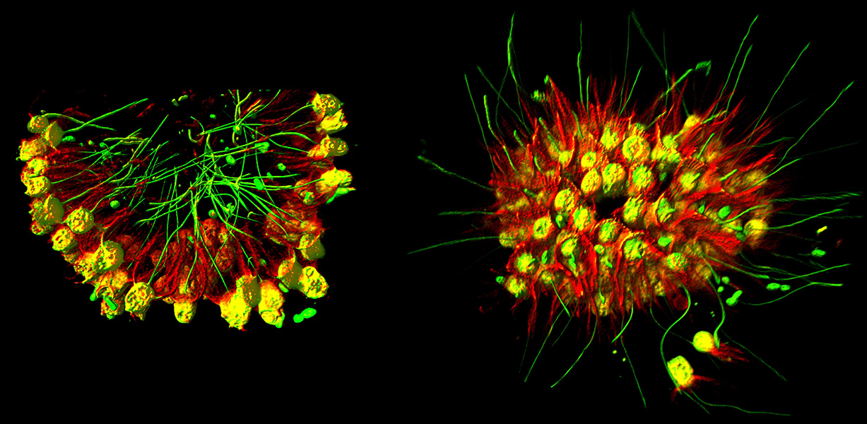 A micrograph shows one-celled life forms with tails stuck together into colonies.