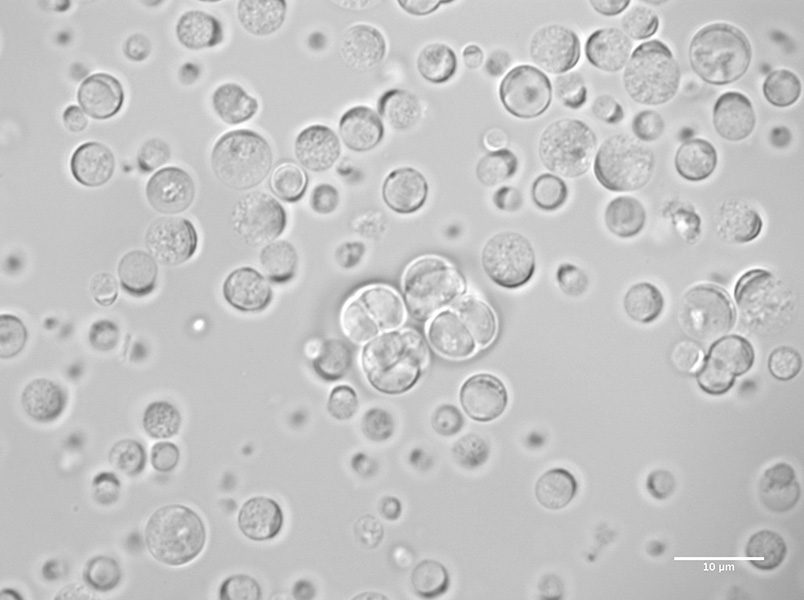 A grayscale micrograph shows single and clustered cells.