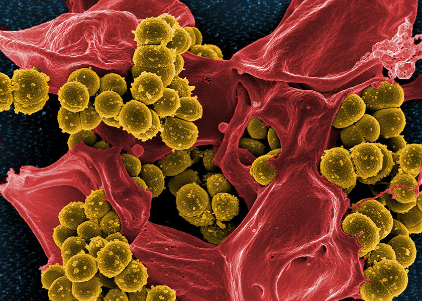 Colored micrograph showing antibiotic-resistant bacteria surrounding a dead blood cell.