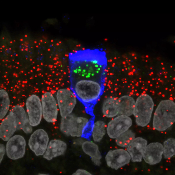 Micrograph of a goblet-shaped cell stained blue